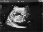 http://forum.anticonceptionale.ro/uploads/thumbs/15436_baby_scan_week17_2.jpg