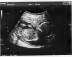 http://forum.anticonceptionale.ro/uploads/thumbs/15436_baby_scan_week17_3.jpg