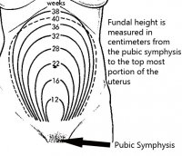 http://forum.anticonceptionale.ro/uploads/thumbs/3717_fundal_height.png