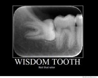 http://forum.anticonceptionale.ro/uploads/thumbs/57470_wisdom-tooth-not-that-wise.jpg